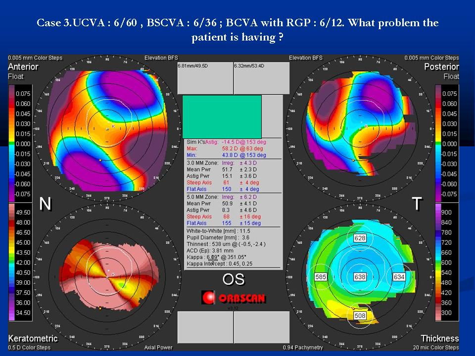 Case examples topography GPrakash (5).JPG