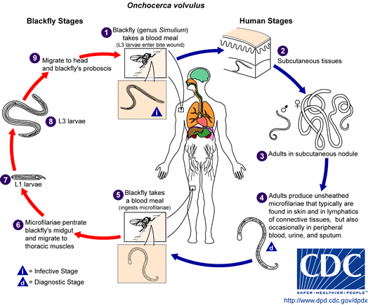 Onchocerciasis Life Cycle