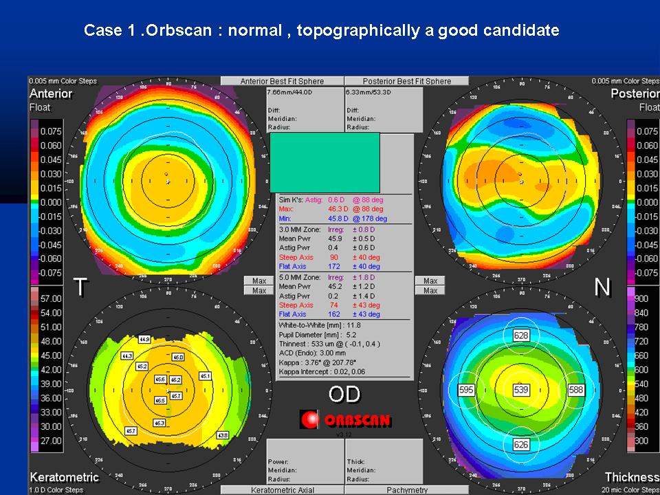 Case examples topography GPrakash (2).JPG