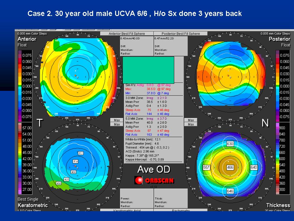 Case examples topography GPrakash (3).JPG