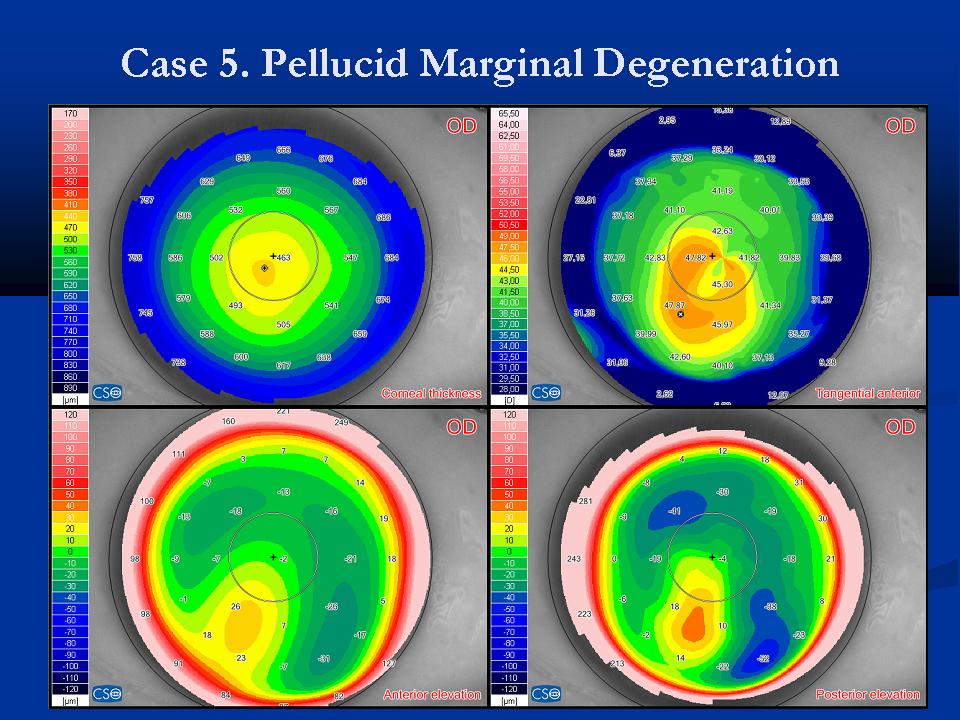 Case examples topography GPrakash (10).JPG