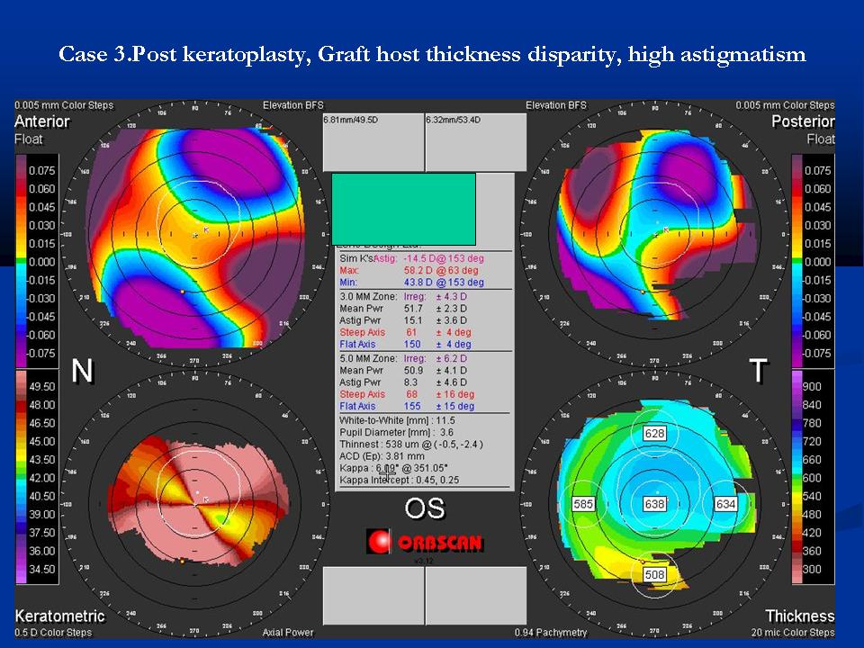 Case examples topography GPrakash (6).JPG