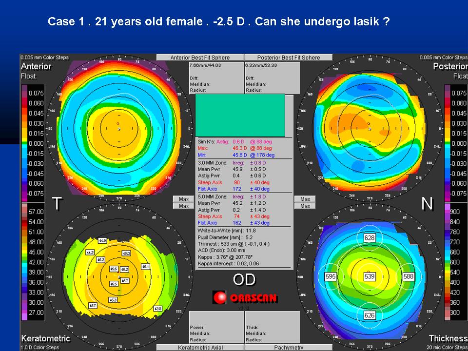 Case examples topography GPrakash (1).JPG