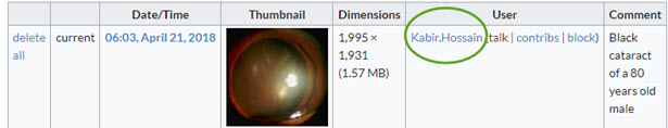 EyeWiki Image Permission.jpg