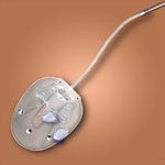 Ahmed-Glaucoma Valve.jpg