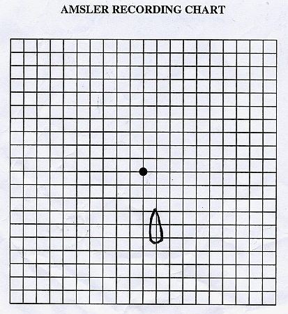 AMN Amsler Grid.jpg