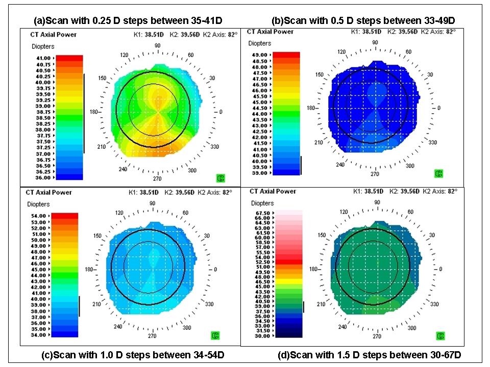 Idesign topo scans GPrakash.jpg