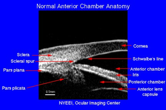 Figure 2a: Ultrasound biomicroscopy depicting the normal anatomy of the anterior chamber[4] (from www.nyee.edu/normal-eye.html).