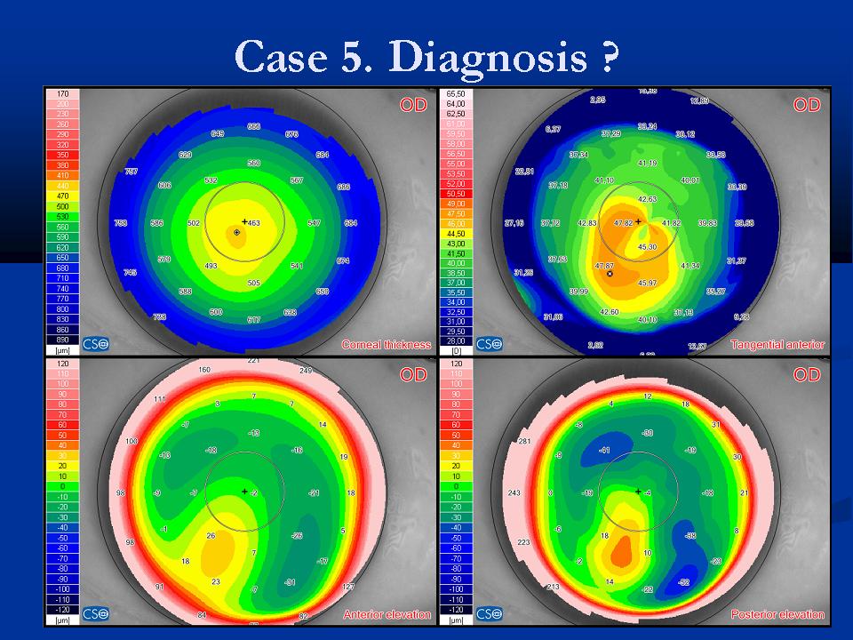 Case examples topography GPrakash (9).JPG