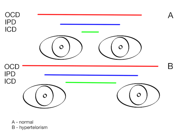 Figure 1 – Increased ODC, IPD and ICD in ORH.