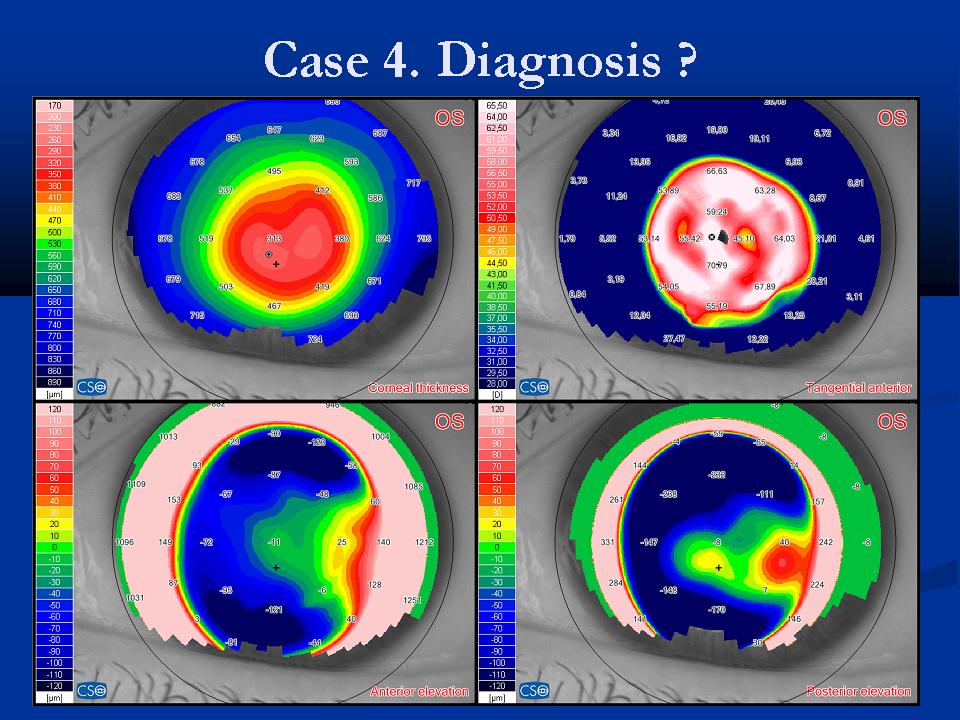 Case examples topography GPrakash (7).JPG