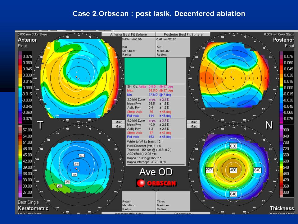 Case examples topography GPrakash (4).JPG