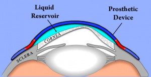 PROSE-Device---horizontal---5-9-2011-flattened.jpg