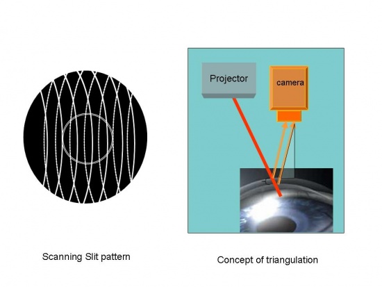 Scanning Slit and concept of triangulation