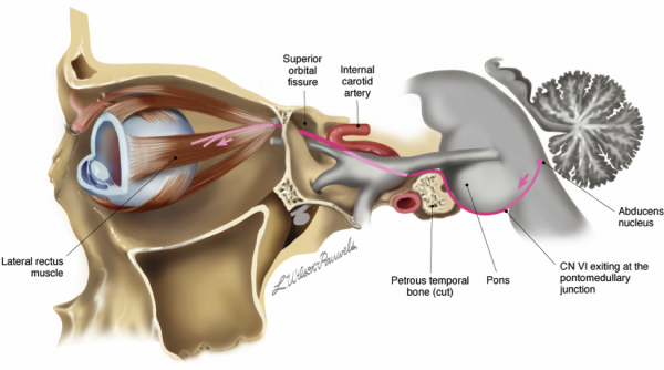 Abducens pathway AAO.png