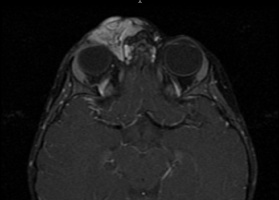 Figure 2: MRI