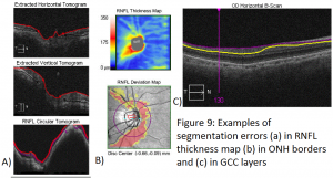 Figure 9 SD-OCT.png