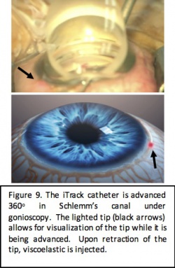 Itrack fig 9 .jpg