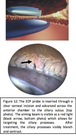 ECP figure 12.jpg