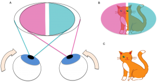 Figure 3. . A) Visual field of both eyes with bitemporal hemianopia and esotropia (left eye visual field indicated in blue, right eye visual field indicated in pink). Note the inward deviation of both eyes. B) Visual fields of an object (cat) at the point of fixation. There is a central vertical strip that does not fall onto either eye’s visual fields C) Image seen by the patient with binocular vision. The central strip of vision is missing.