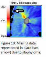 Figure 10 SD-OCT.png