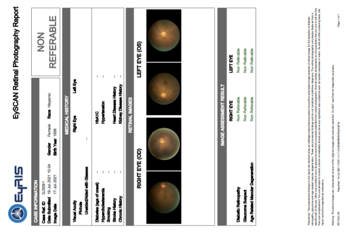 Figure 5. Example report generated by SELENA+, indicating no need for referral for diabetic retinopathy, glaucoma suspect, and age-related macular degeneration. On the report itself, retinal photographs are thumb prints set on low resolution so as to accelerate the download from the cloud to the end-user.