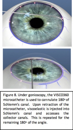 Visco 360 fig8.jpg