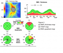 Figure 1 SD-OCT.png