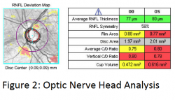 Figure 2 SD-OCT.png