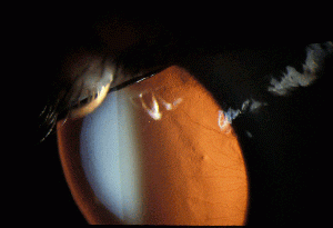 CL-Circinate-Sugar-Retro.gif