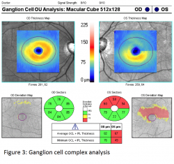 Figure 3 SD-OCT.png