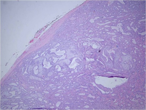 PALG Histology Low Magnification.jpg