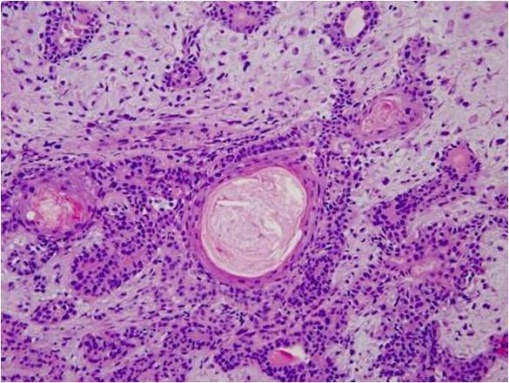 PALG Histology High Magnification.jpg