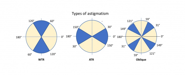 Astigmatism diagram.jpg