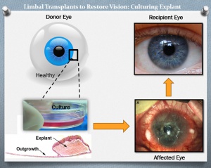 Limbal Explant Culture.jpg