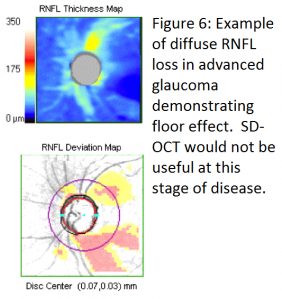 Figure 6 SD-OCT.png