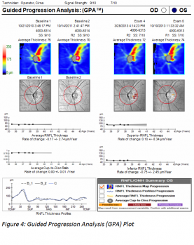 Figure 4 SD-OCT.png