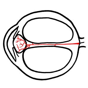 Illustration of fetal ocular vasculature, consisting of a red hyaloid artery running through Cloquet’s canal to the back part of the lens.